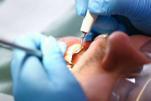 Best Teeth Whitening  in Anoka, MN
