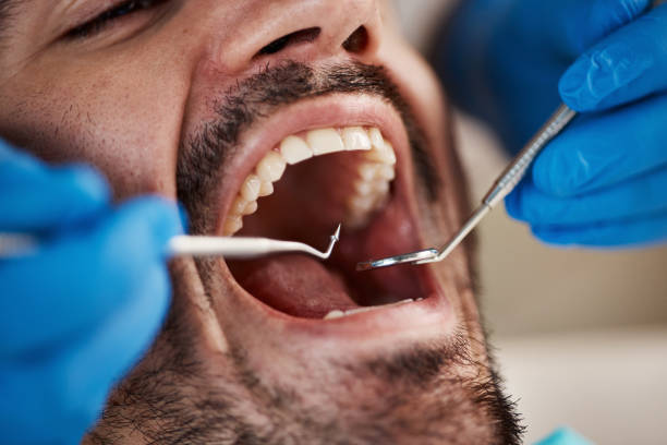 Best Urgent Tooth Repair  in Anoka, MN